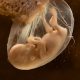 Iowa Senate passes bill banning abortions once heartbeat is detected www.teapartytribune.compr-58878ab3bf30a57443d4551833247b5b4da04c8f